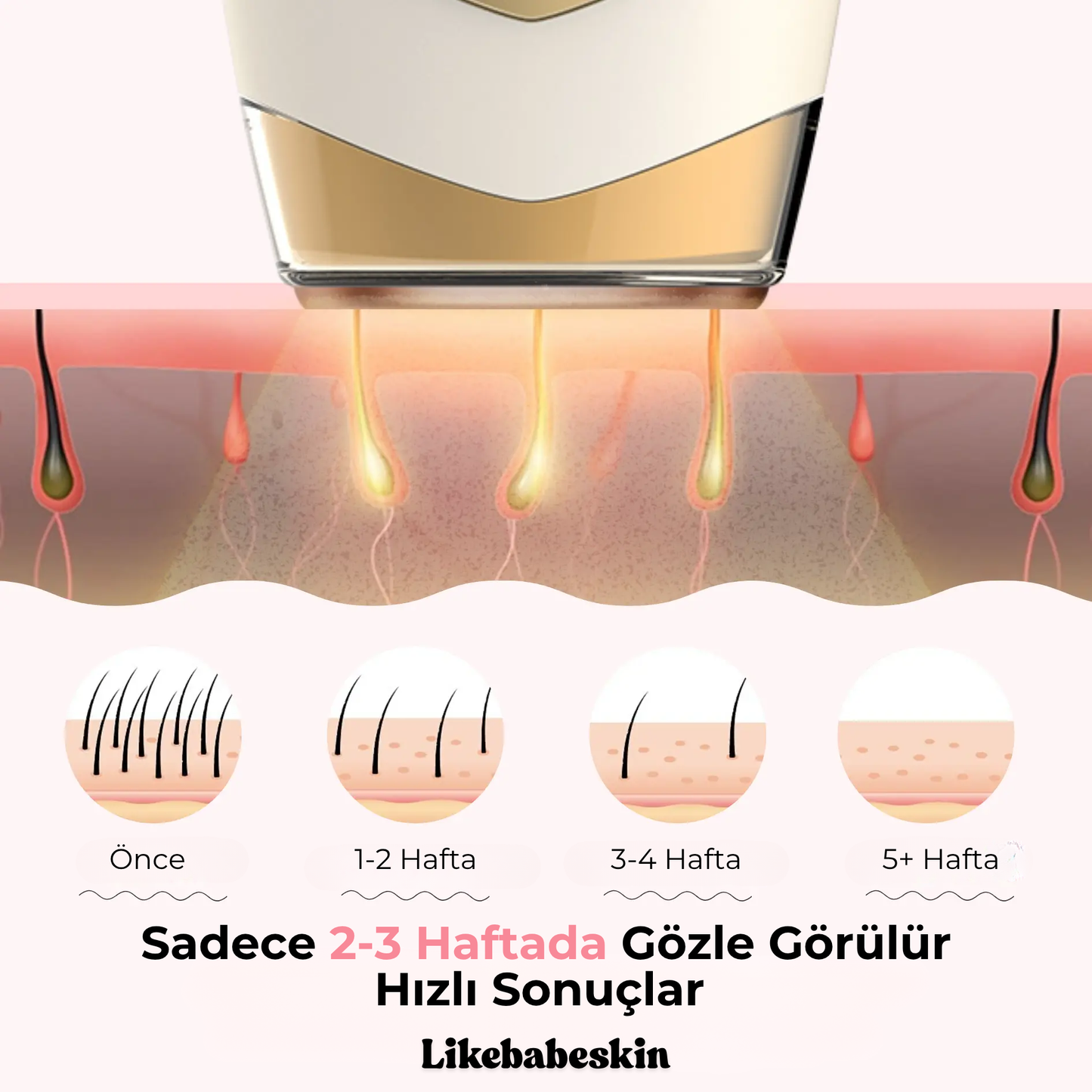 Likebabeskin IPL Epilasyon Aleti