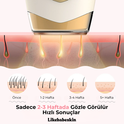 Likebabeskin IPL Epilasyon Aleti